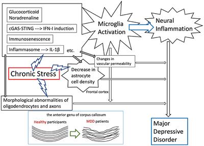 Involvement of inflammatory responses in the brain to the onset of major depressive disorder due to stress exposure